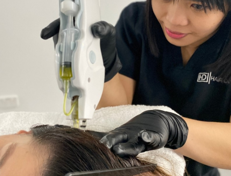Scalp Mesotherapy