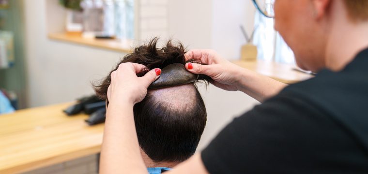 Hair Replacement Or Hair Transplant | Pros & Cons | Hair Loss Management | Hair Restoration Clinic Sydney, Melbourne, Parramatta | Hair Doctors